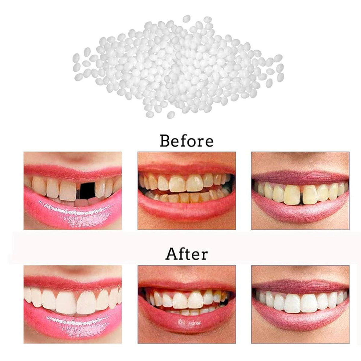 پروتز موقت دندان South Moon