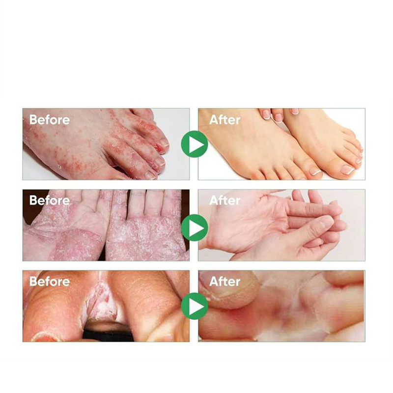 اسپری گیاهی ضدبو و درمان زخم پا-چند رنگ